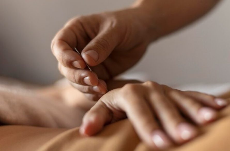 Сонник иглоукалывание