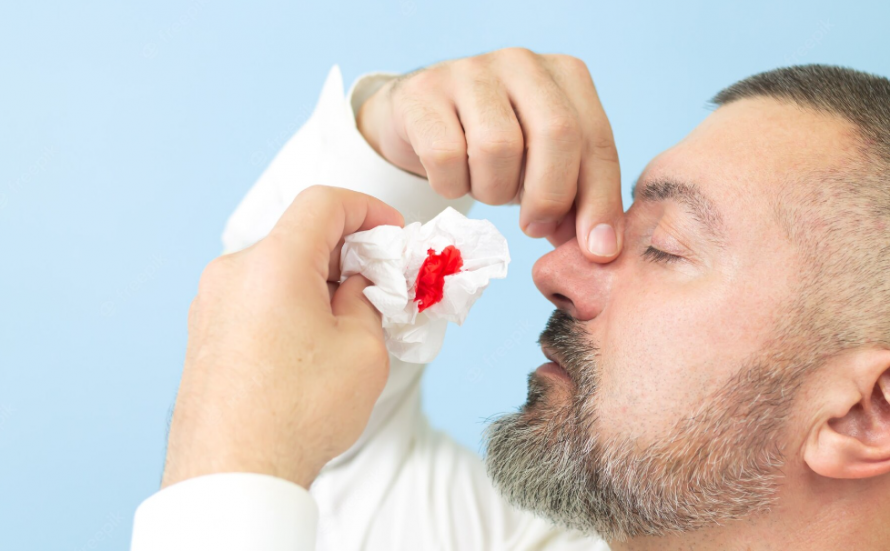 Сонник кровотечение из носа