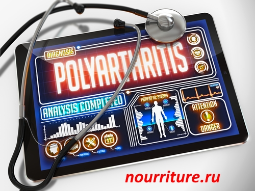 Polyarthritis.jpg