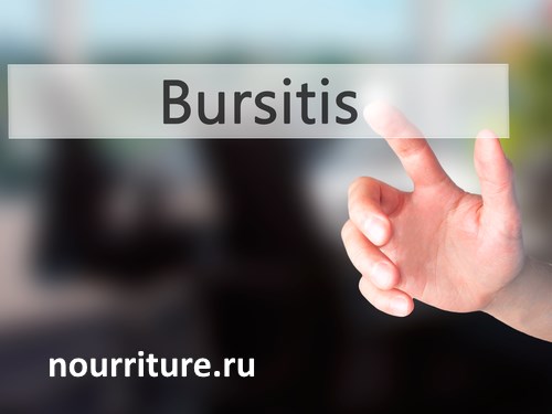 Bursitis.jpg