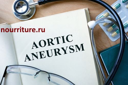 Aortic-aneurysm.jpg